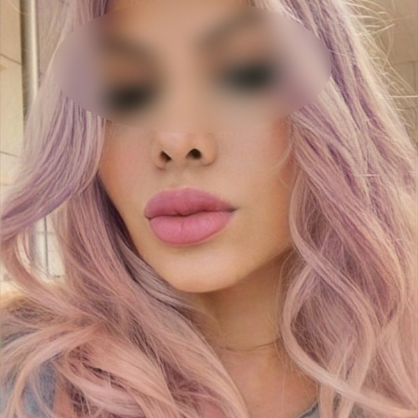 LIO Top-Massage Nur Haus und Hotelbesuche